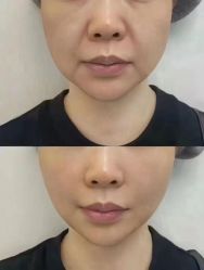 -克丽缇娜
