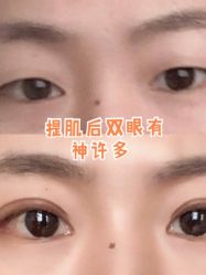 -上海时光整形外科医院