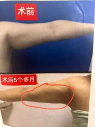 -深圳艺星医疗美容医院