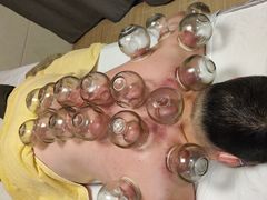 -安琪盲人按摩调理草本熏蒸馆(风和日丽店)