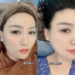 -广州健丽·去眼袋医疗美容机构