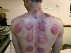 -安琪盲人按摩调理草本熏蒸馆(风和日丽店)