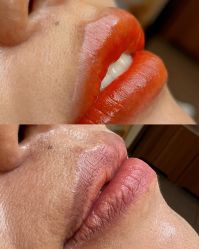 -德绣·机器野生眉发际线·美瞳线半永久