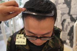 点击看大图 -大麦微针植发丨全国连锁