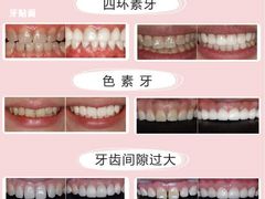 -团圆口腔·种植中心(锦江院区)