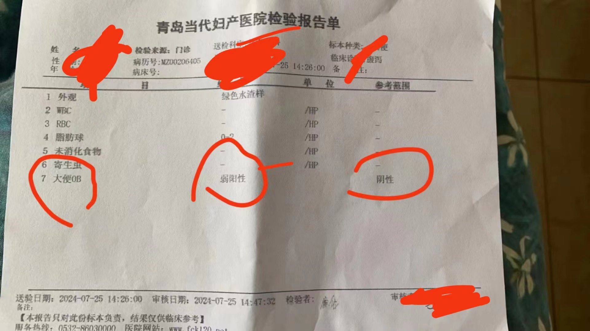 新生儿大便 ob(潜血)显示弱阳性可能存