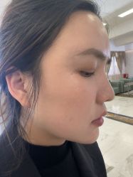 -长沙雅美医疗美容医院