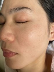 -+MS卓美丝专业祛痘·皮肤管理中心