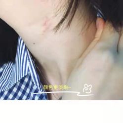 -成都军建医院·疤痕诊疗中心