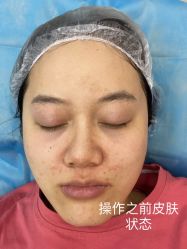 -Yestar艺星医疗美容医院