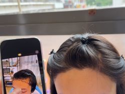 -碧莲盛·不剃发植发