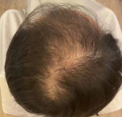 -乐绅男士高端假发定制