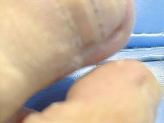 -祖传修脚甲沟炎灰指甲鸡眼