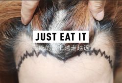 -大麦微针植发全国连锁