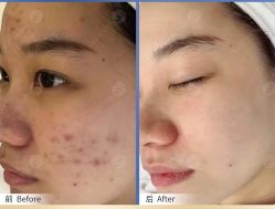 -美肤盾祛痘·问题肌头疗管理中心