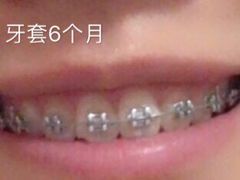 -永靓口腔.数字化种植矫正中心