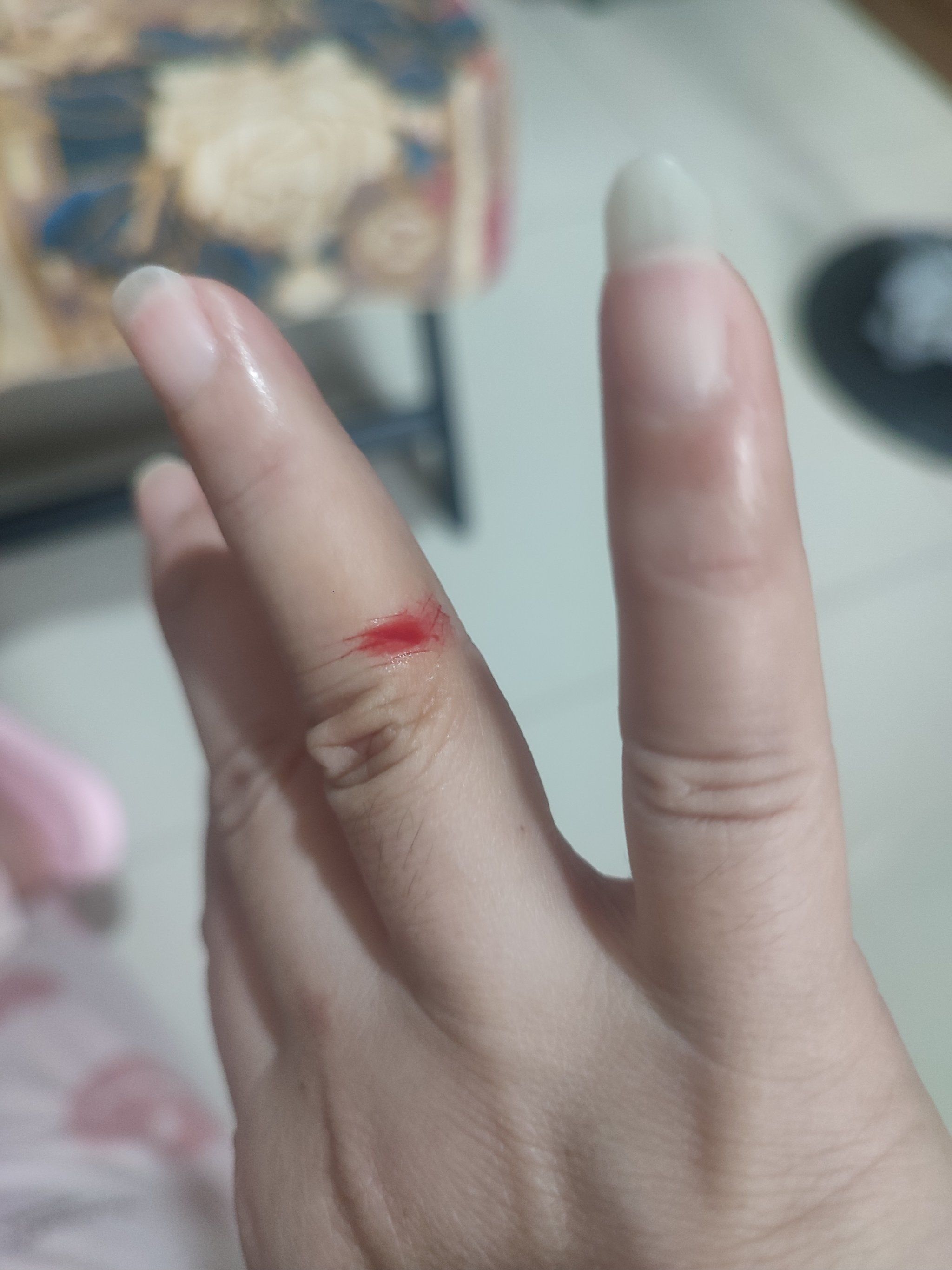 手指小伤不哭泣