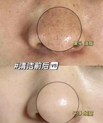 -智丽佳人祛斑祛痘美容美体