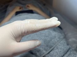 -倩极·精研痘敏肌管理