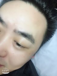 点击看大图 -西施无菌半永久纹绣眉眼影唇轻增发纹发际线