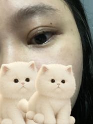 体验后-广州美莱医疗美容医院