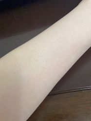 -Yestar艺星整形