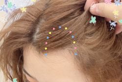 -大麦微针植发全国连锁