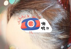 -大麦微针植发全国连锁