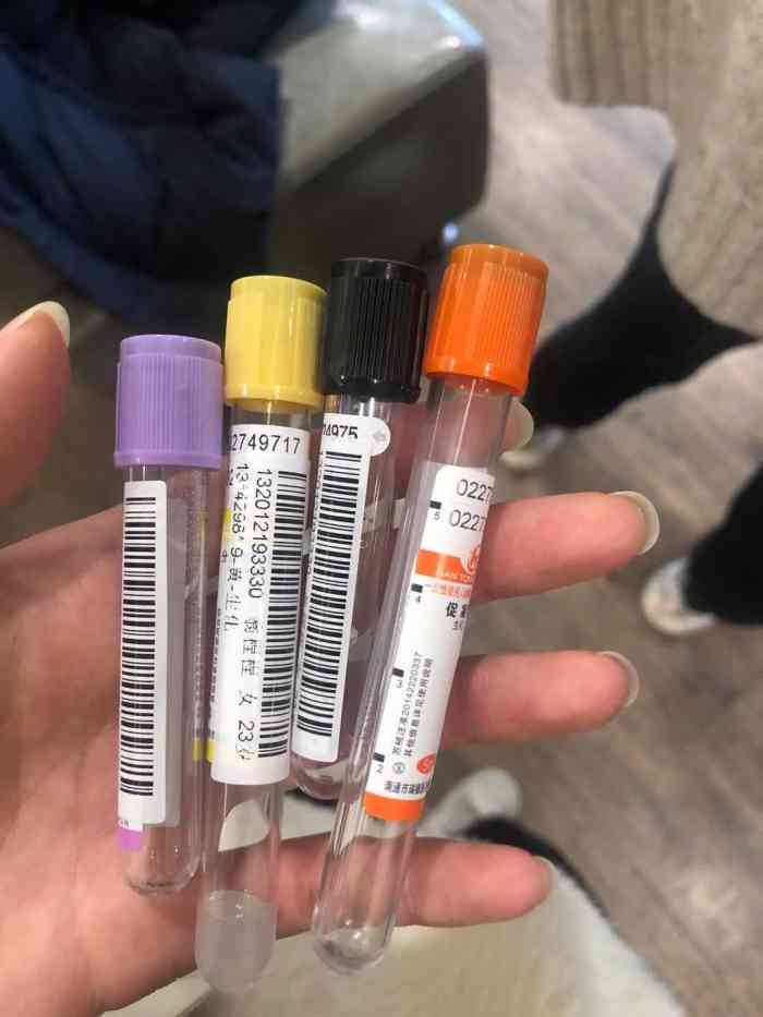 但是这个抽血管子真是吓到我了,以前体检好像没抽过这么大量的血