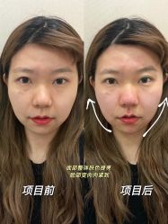 -北京米扬丽格医疗美容·联合丽格鼻整形中心