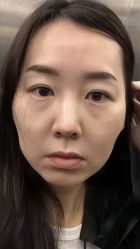 体验前-南京康美美容医院·旗舰店
