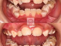 -Dr.Z dental仁康种植矫正中心