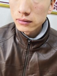 -北京美痣堂古方祛痣斑疣瘊