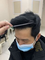 -大麦微针植发丨全国连锁