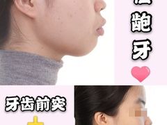 -团圆口腔·种植中心(锦江院区)