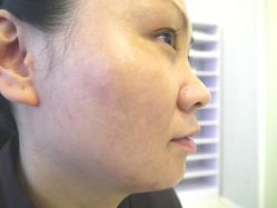 P1090198-芷妍医美