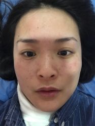 -郑州米兰柏羽集美医疗美容医院