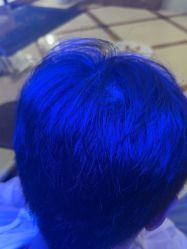 -碧莲盛·不剃发植发