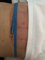 -肥三针腧穴瘦身馆