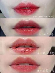 -郡艺医疗美容·微整·眼鼻吸脂