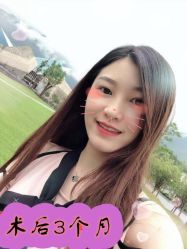 -大麦微针植发全国连锁