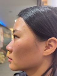 -长沙雅美医疗美容医院