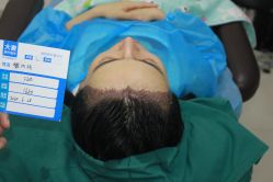 -大麦微针植发丨全国连锁