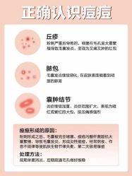 点击看大图 -美肤盾祛痘·问题肌头疗管理中心