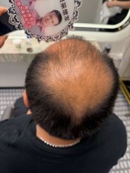 -唐风采假发补发定制