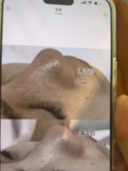 -苑苑vbeauty科技美容SPA