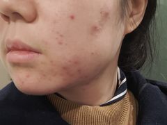 -杭州市第三人民医院