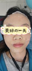 -天津健丽·去眼袋医疗美容机构