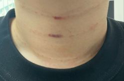 -深圳米兰柏羽医疗美容医院