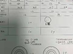 -黑马眼科·近视手术